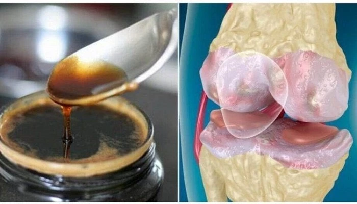 Φυσική θεραπεία για την εδυνάμωση των οστών και των αρθρώσεων